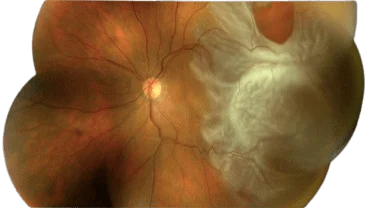 Orbit & Oculoplasty