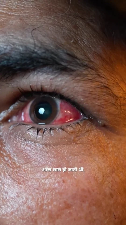 Shubhanu Eye Hospital Instagram Reel